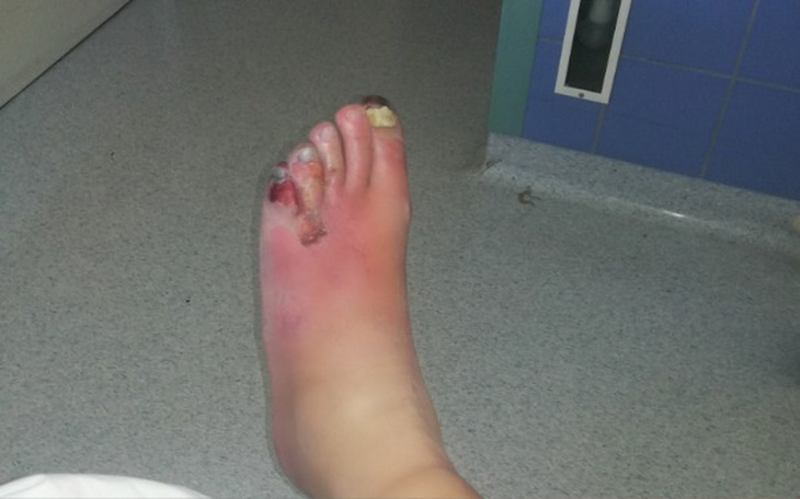 Zbiórka Życie po amputacji - zdjęcie główne