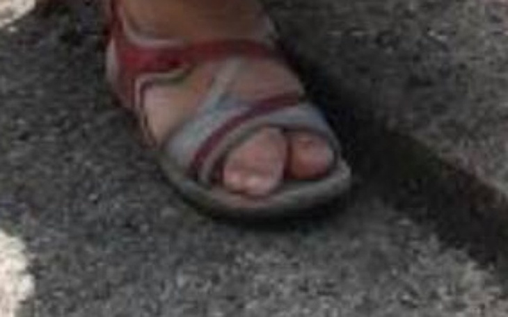 Zbiórka Operacja ortopedyczna - zdjęcie główne