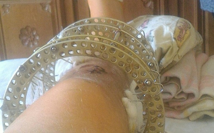 Zbiórka żeby pomóc stanąć na nogi - zdjęcie główne