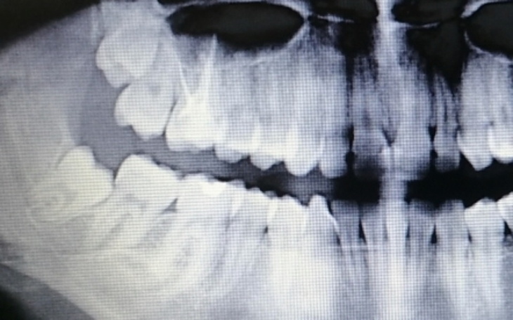 Zbiórka Pomoc w leczeniu i walce - zdjęcie główne