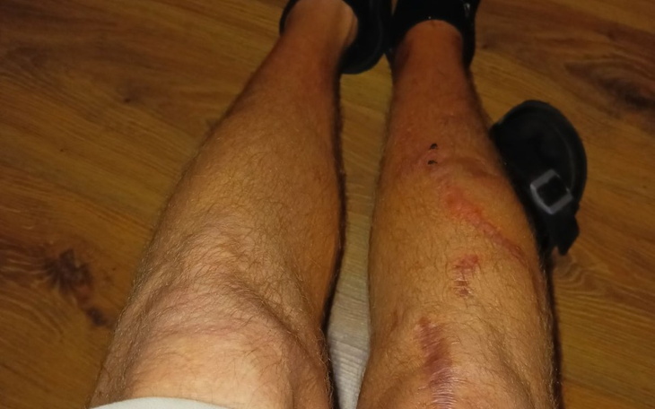 Zbiórka Leczenie i rehabilitacja 2jn1 - zdjęcie główne