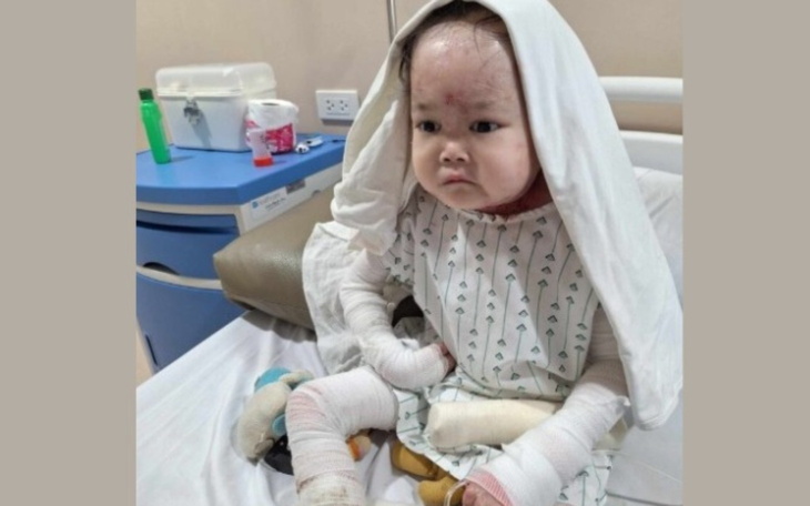 Dziecko w szpitalu, z opatrunkami na rękach i twarzy.