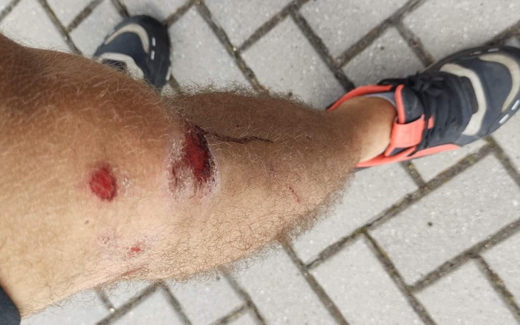 Zbiórka Rekonstrukcja wiązadeł krzyżowyh - zdjęcie główne