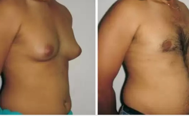 Zbiórka Zabieg ratujący młodość - zdjęcie główne