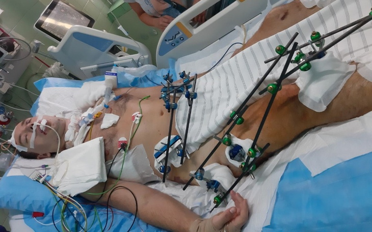 Mężczyzna w szpitalu, podłączony do aparatury medycznej.