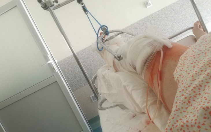 Zbiórka Endoproteza biodra i kolana - zdjęcie główne