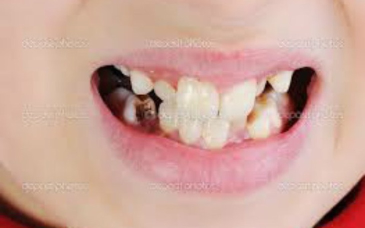 Zbiórka leczenie zebow - zdjęcie główne