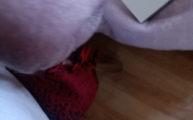 Zbiórka Proteza 1r - zdjęcie główne