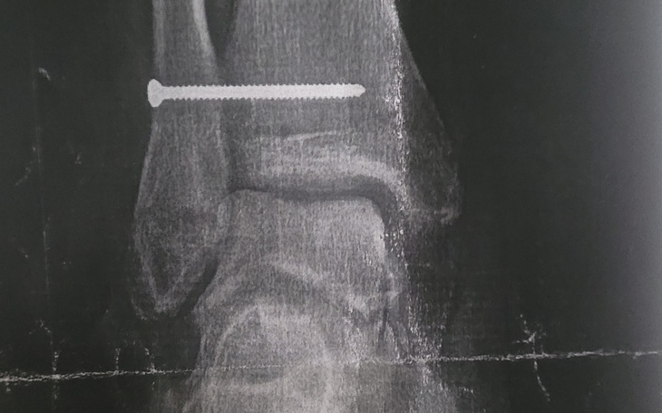 Zbiórka Zbiórka na powrót do pracy - zdjęcie główne