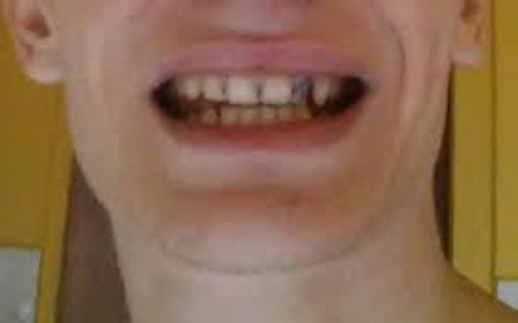 Zbiórka na zęby dla zietka - zdjęcie główne