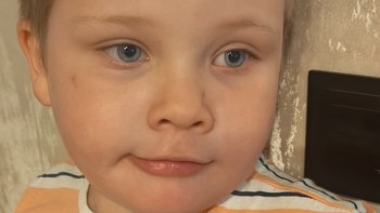 Zbiórka Pomóżmy Tymonowi walczyć o lepsze jutro - miniaturka zdjęcia