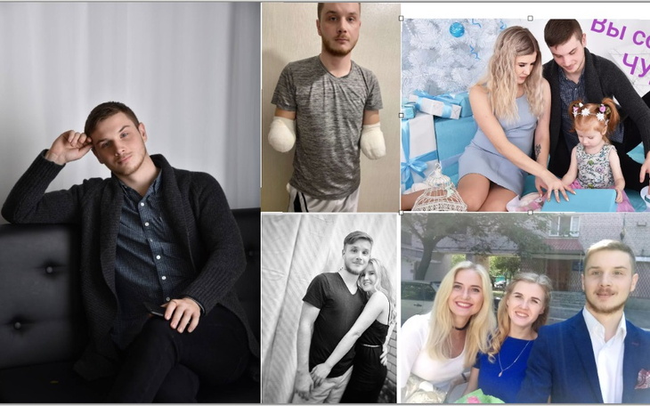 Zbiórka Pomoc w zakupie protez rąk - zdjęcie główne