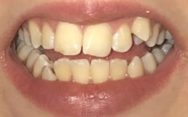 Zbiórka Aparat Ortodontyczny Pomoc - zdjęcie główne