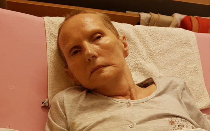 Zbiórka Wsparcie dla Teresy Nadolskiej - zdjęcie główne