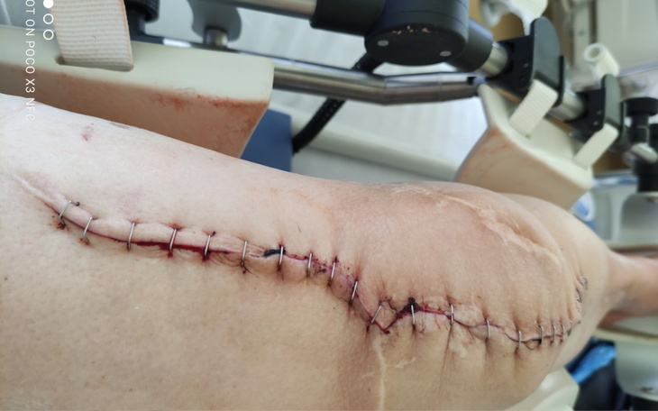 Zbiórka Rehabilitacja i dojazdy ,do spec - zdjęcie główne