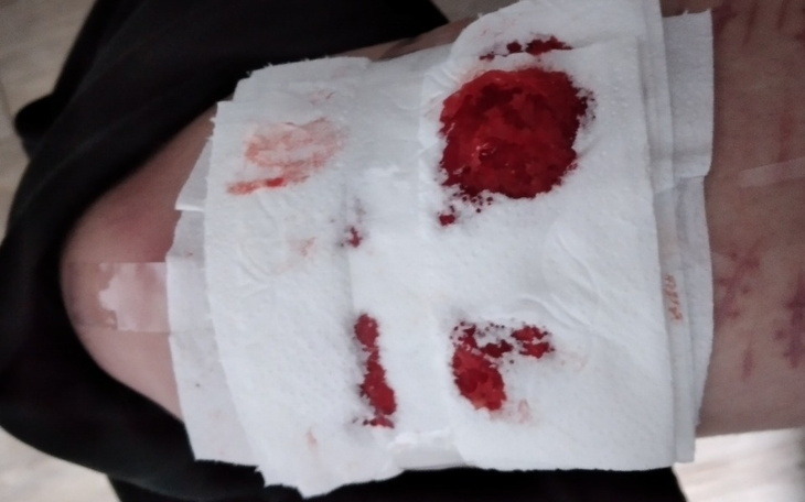 Zbiórka Depresja i brak środków do życia - zdjęcie główne