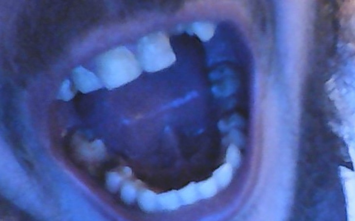 Zbiórka Mój nowy uśmiech. - zdjęcie główne