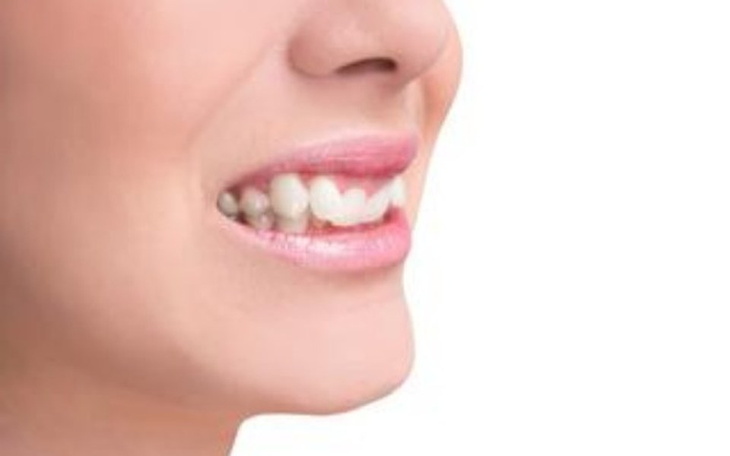 Zbiórka Na leczenie zabkow dziewczynki - zdjęcie główne