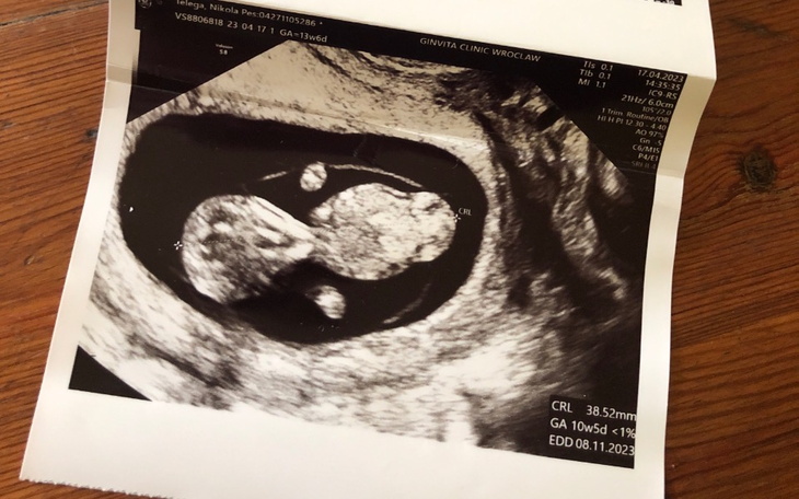 Zbiórka Ubranka akcesoria dla maluszka - zdjęcie główne