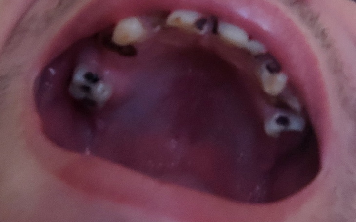 Zbiórka Odnowienie zębów - zdjęcie główne