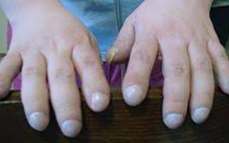 Zbiórka na kabanosy - zdjęcie główne