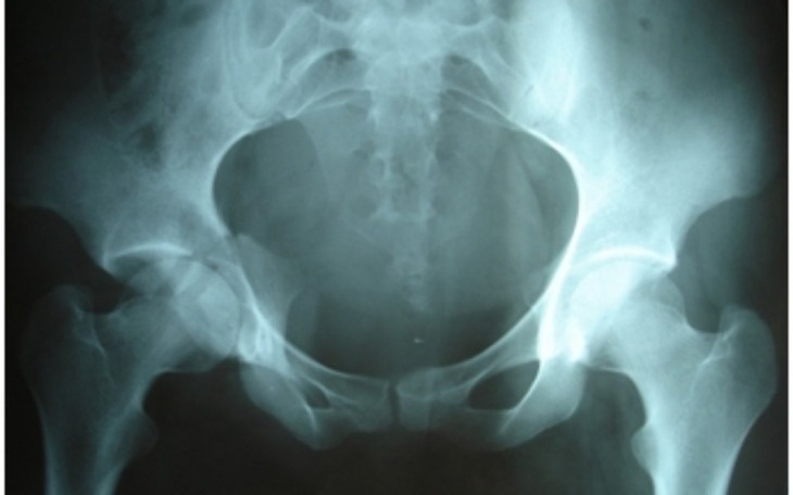 Zbiórka Potracony pies - zdjęcie główne