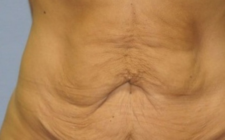 Zbiórka Operacja brzucha.. - zdjęcie główne