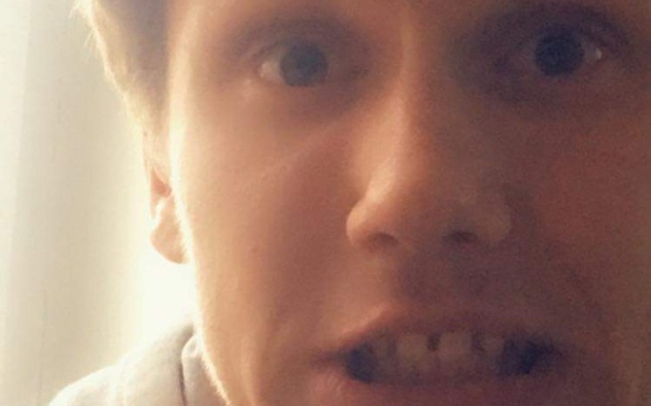 Zbiórka Na zęby Kazika - zdjęcie główne