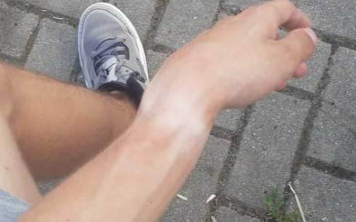 Zbiórka Rehabilitacja medyczna ręki - zdjęcie główne