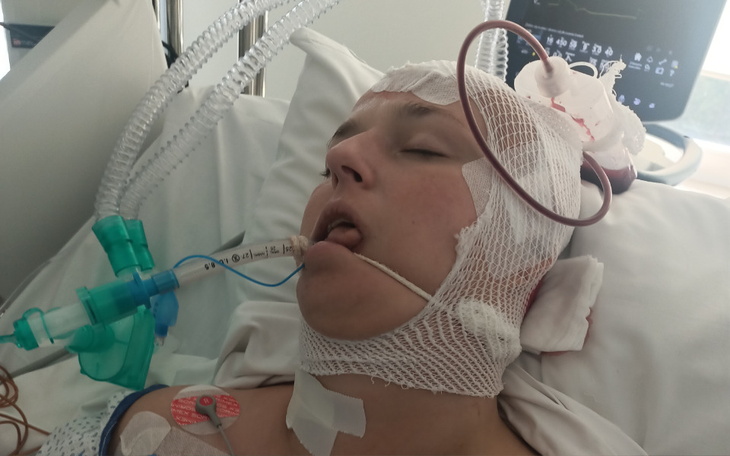 Osoba w szpitalu, z opatrunkiem na głowie i rurkami medycznymi.