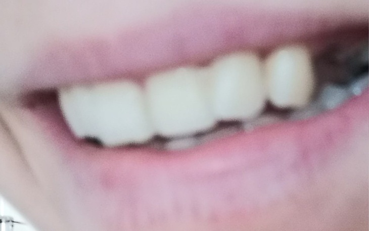 Zbiórka Na nowe uzębienie - zdjęcie główne