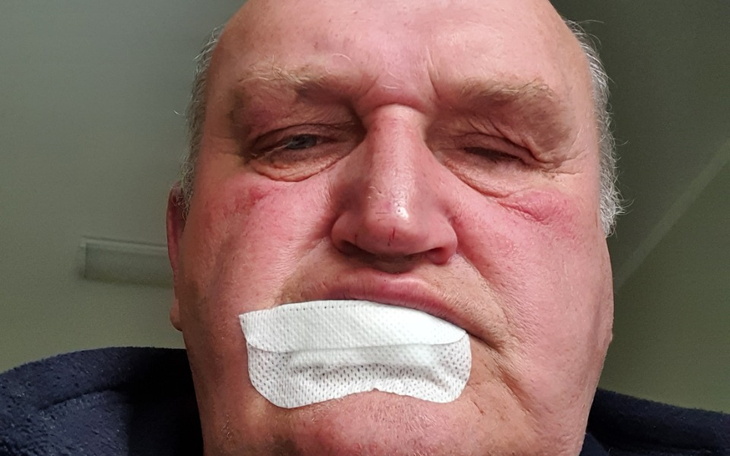 Zbiórka Leczenie leki oplaty - zdjęcie główne