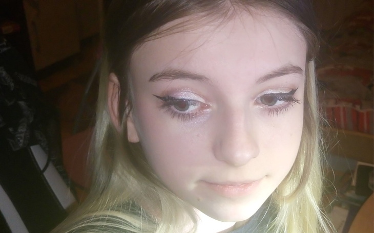 Zbiórka Kręgosłupa CÓRKI musi być operow - zdjęcie główne