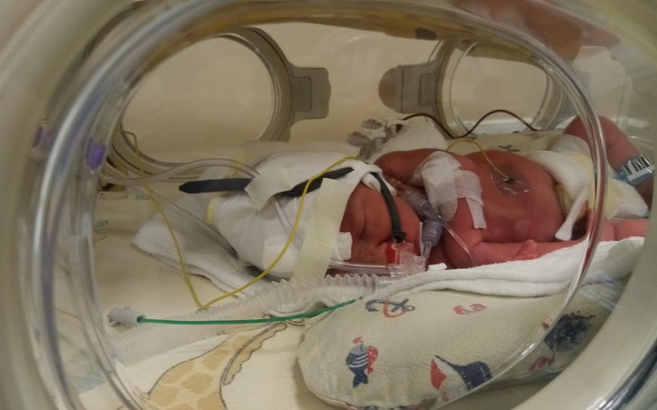 Zbiórka Pielucha dla Malucha - zdjęcie główne