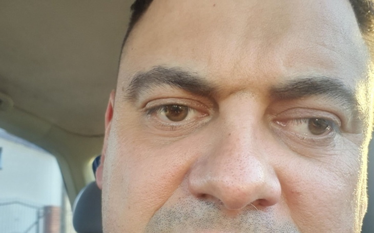 Zbiórka Patryk Stożek Rogówki - zdjęcie główne