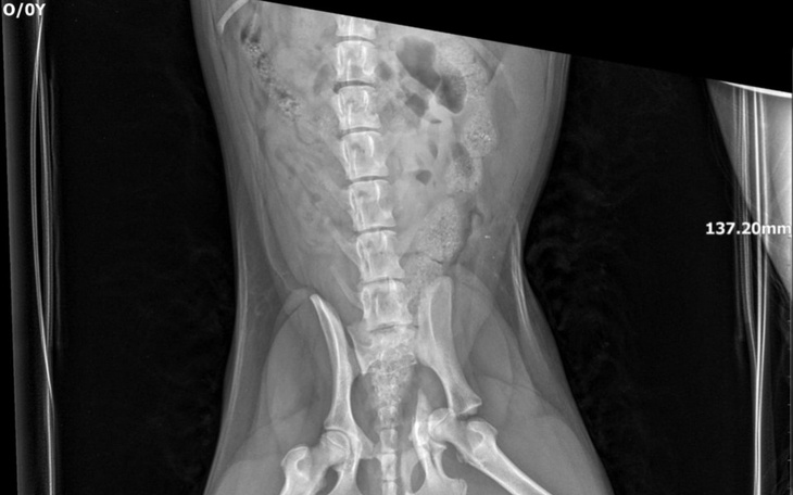 Rentgen kręgosłupa, pokazujący szczegóły anatomiczne.