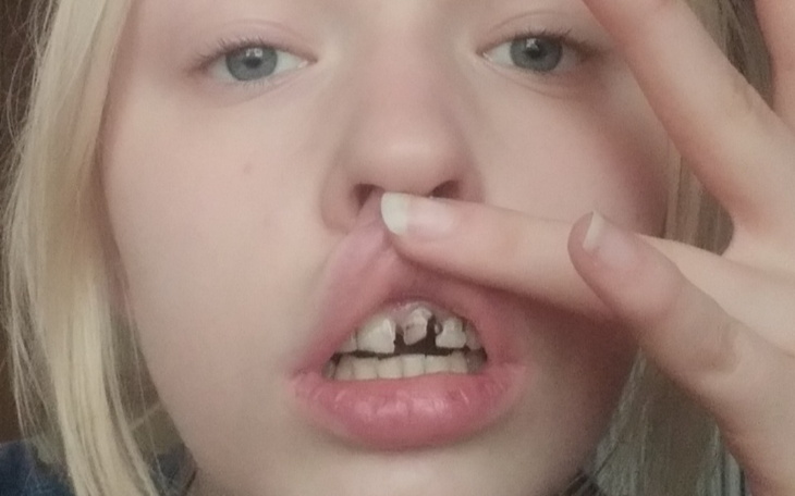 Zbiórka Pomożesz mi się uśmiechnąć - zdjęcie główne