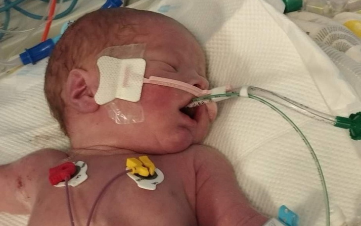 Noworodek w inkubatorze z podłączonymi urządzeniami.