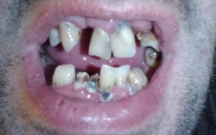 Zbiórka By się w końcu uśmiechnąć.. :( - zdjęcie główne