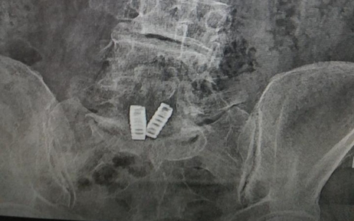 Zbiórka Błaganie pomoc - zdjęcie główne