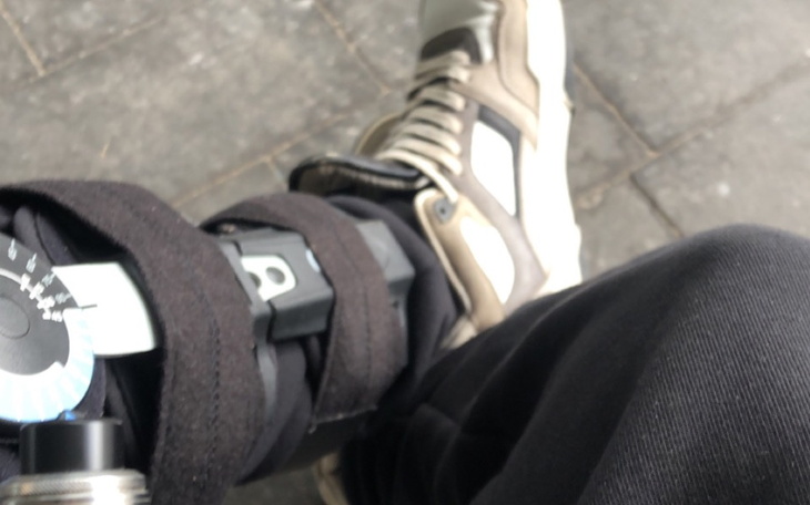 Zbliżenie na nogę z opatrunkiem i specjalnym urządzeniem.