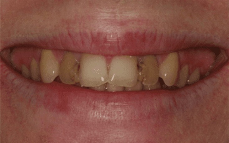 Zbiórka Naprawa zebow - zdjęcie główne