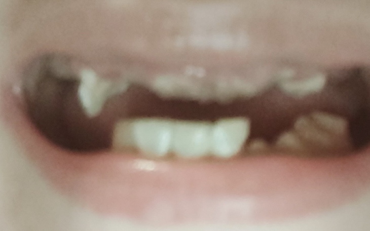 Zbiórka Na uśmiech bez wstydu i zdrowie - zdjęcie główne