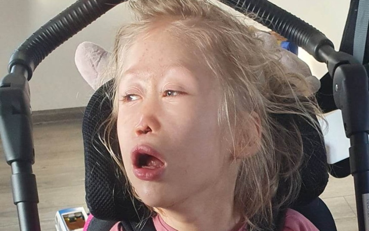 Zbiórka Turnus rehabilitacyjny dla Amelk - zdjęcie główne