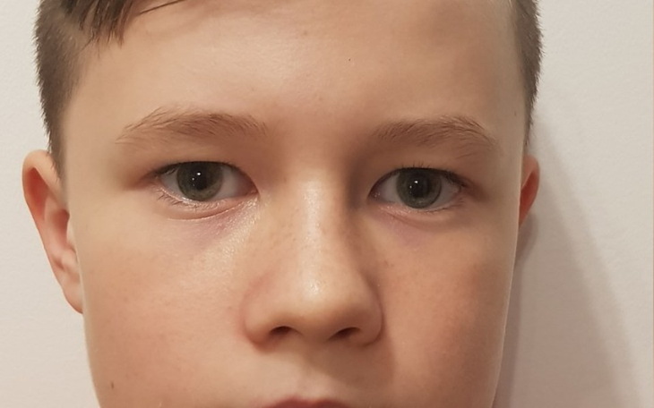 Zbiórka Uporać z rakiem - zdjęcie główne