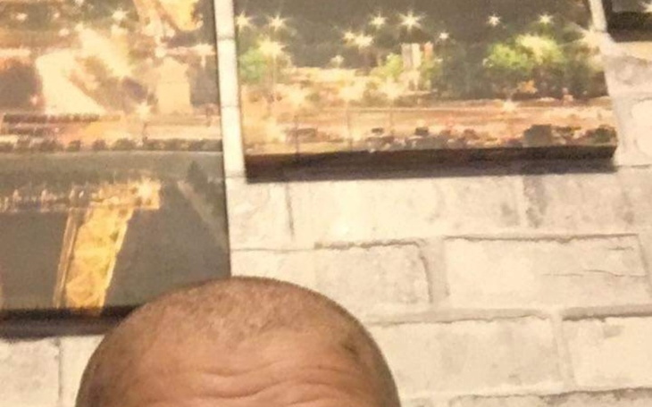 Zbiórka Na peruke dla mojej siostry - zdjęcie główne