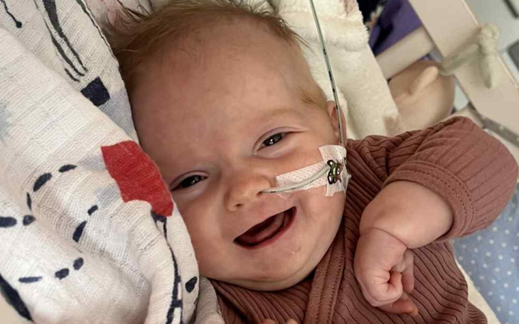 Uśmiechnięte niemowlę z rurką tlenową, radosny moment.