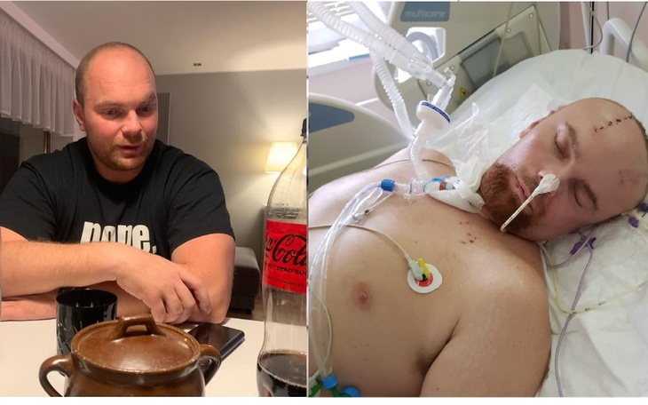 Mężczyzna siedzi przy stole, z widocznymi ranami na głowie.