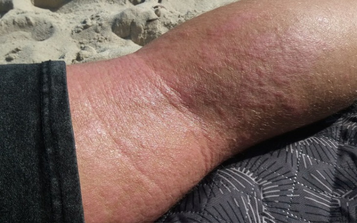 Zbiórka oczyszczacz powietrza+ osuszacz - zdjęcie główne