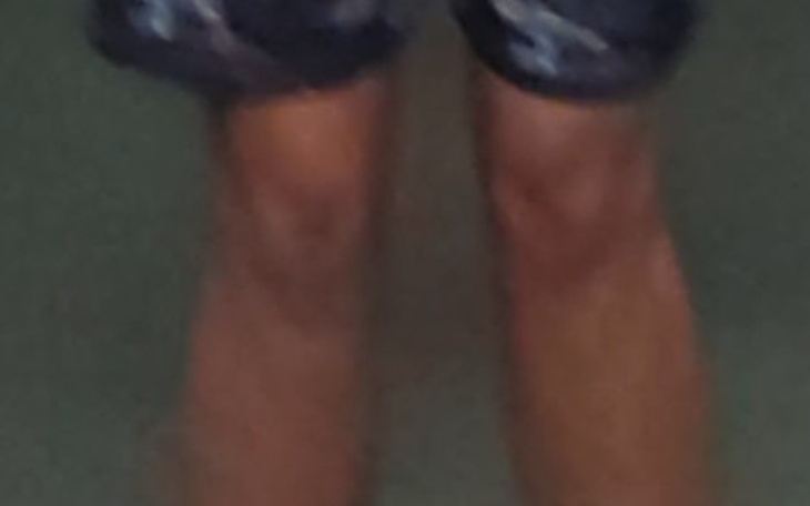 Zbiórka Zbiorka na leczenie i opał - zdjęcie główne